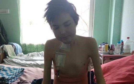 Одесские волонтеры вернули к жизни парня, который после года жизни в одесской больнице попал в реанимацию «фото»
