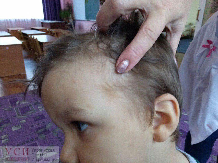 В “Радужном” гражданка Беларуси избивала и душила своего ребенка. Малыша забрали и разыскивают его родственников «фото»