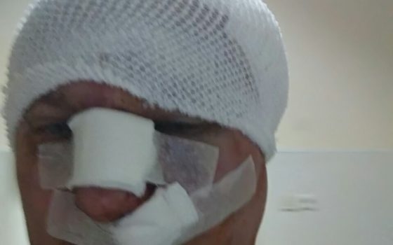 Догхантеру проломили череп на выходе из суда (фото) «фото»