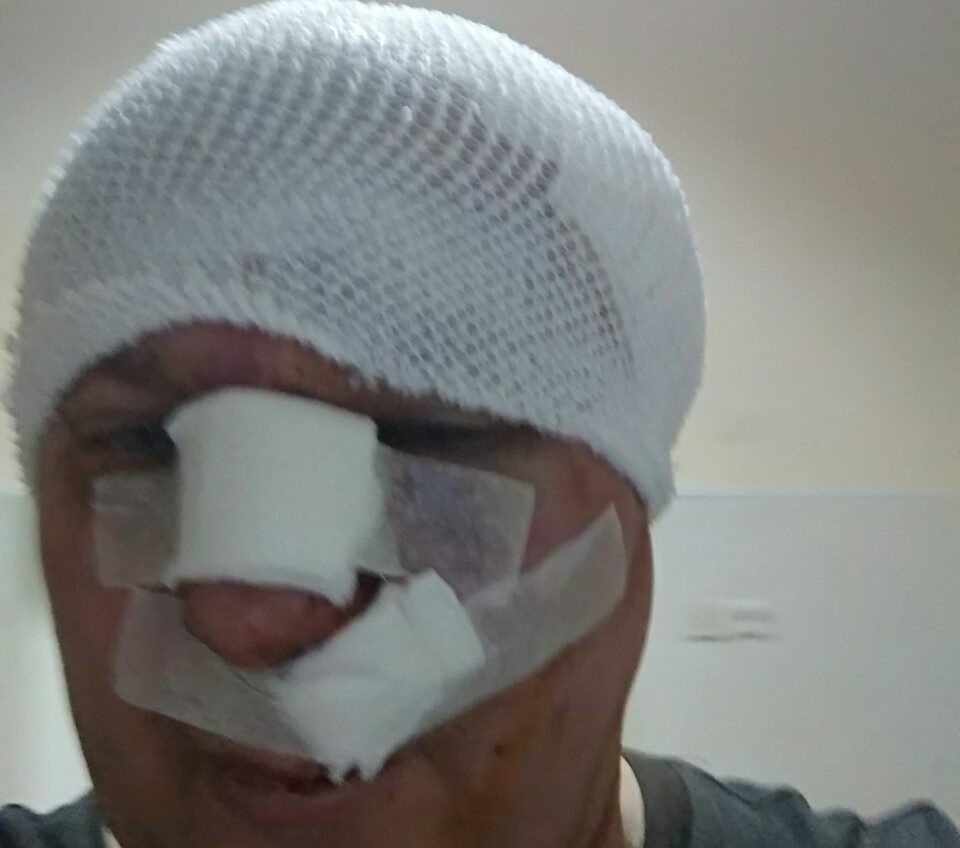 Догхантеру проломили череп на выходе из суда (фото) «фото»