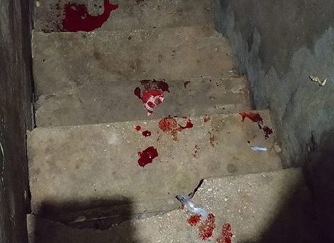 Одессит упал с разрушенной лестницы в парадной старого дома: его без сознания забрала скорая (фото) «фото»