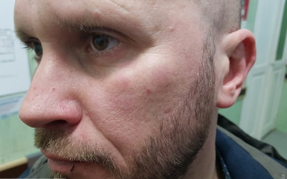 В Одессе напали на журналиста (фото) «фото»