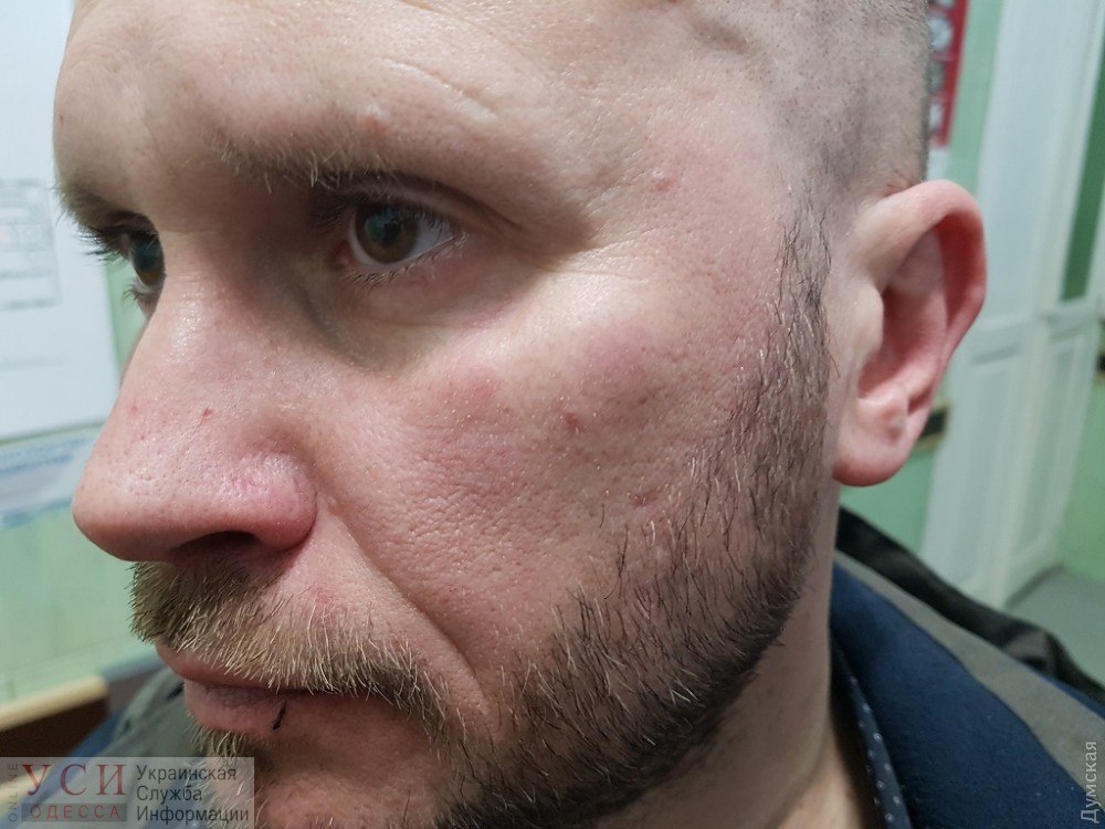 В Одессе напали на журналиста (фото) «фото»