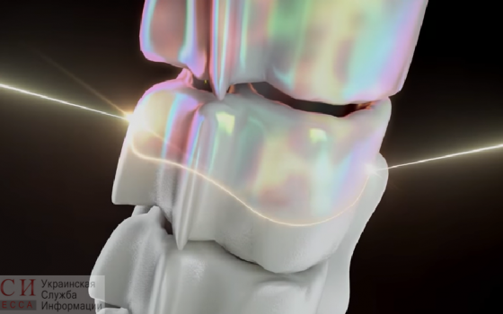 Идеи одесского стартапа заинтересовали весь мир: новые 3D технологии воссоздают точную копию человеческих костей (видео) «фото»