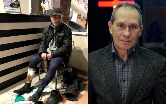 До и после. Как меняются одесские бездомные после того как попадают в реабилитационный центр (фото) usionline.com До и после. Как меняются одесские бездомные после того как попадают в реабилитационный центр (фото) «фото»