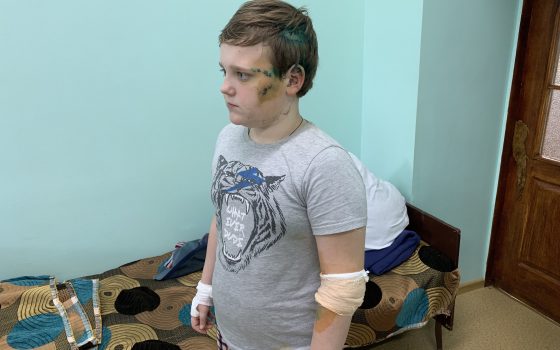 “Они повалили меня на землю и стали кусать за голову и спину”, – третьеклассник рассказал о том, как на него напали алабаи (фото) usionline.com “Они повалили меня на землю и стали кусать за голову и спину”, – третьеклассник рассказал о том, как на него напали алабаи (фото) «фото»