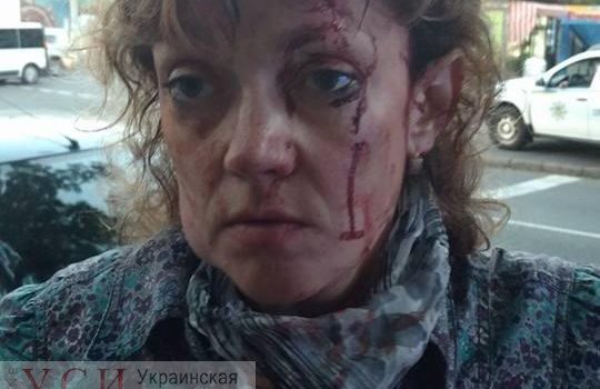 Неугодные или черный список Труханова: когда закончатся заказные покушения на жизнь одесских активистов (видео) «фото»