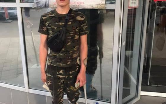 В Измаиле школьник собирает деньги на ампутацию своей ноги после жутких травм от избиения отцом (фото) usionline.com В Измаиле школьник собирает деньги на ампутацию своей ноги после жутких травм от избиения отцом (фото) «фото»