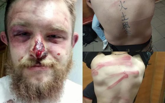 Охранники фирмы “Зевс”, приближенной к Труханову, избили двоих представителей Нацкорпуса (фото) «фото»