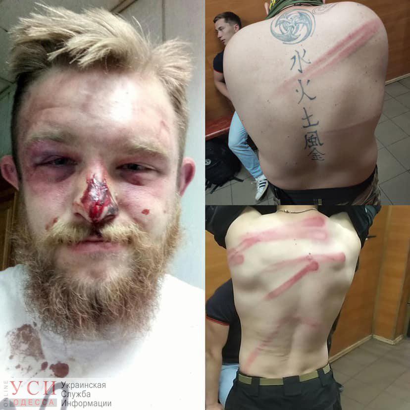 Охранники фирмы “Зевс”, приближенной к Труханову, избили двоих представителей Нацкорпуса (фото) «фото»