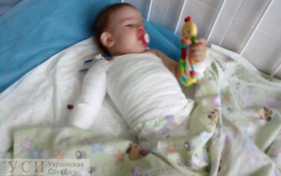 В Одессе на годовалую девочку упал чайник с кипятком: ребенок получил 25% ожогов тела «фото»