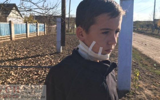 Под Одессой мужчина сядет на 10 лет в тюрьму за то, что искромсал ножом шею 12-летнего племянника usionline.com Под Одессой мужчина сядет на 10 лет в тюрьму за то, что искромсал ножом шею 12-летнего племянника «фото»