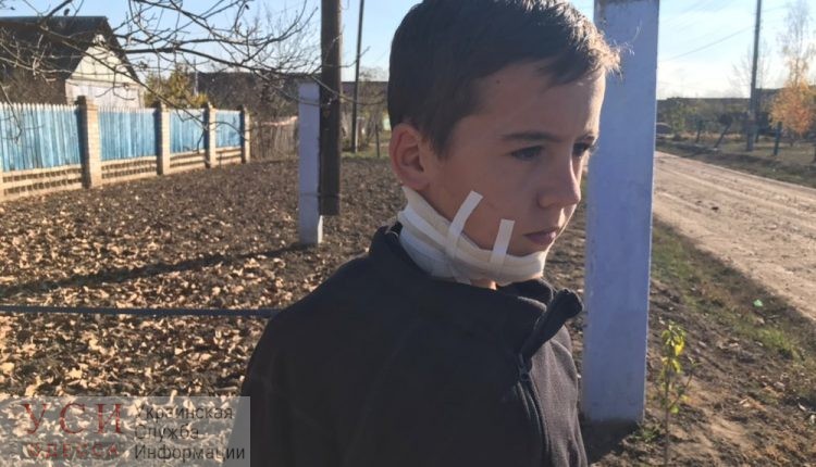 Под Одессой мужчина сядет на 10 лет в тюрьму за то, что искромсал ножом шею 12-летнего племянника «фото»