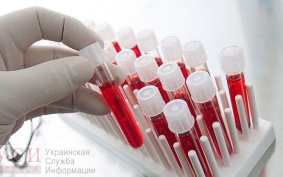 Центр переливания крови в Одессе закупает новое медоборудование usionline.com Центр переливания крови в Одессе закупает новое медоборудование «фото»