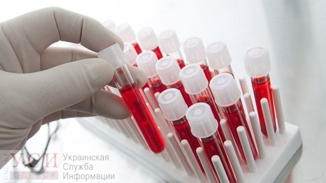 Центр переливания крови в Одессе закупает новое медоборудование «фото»