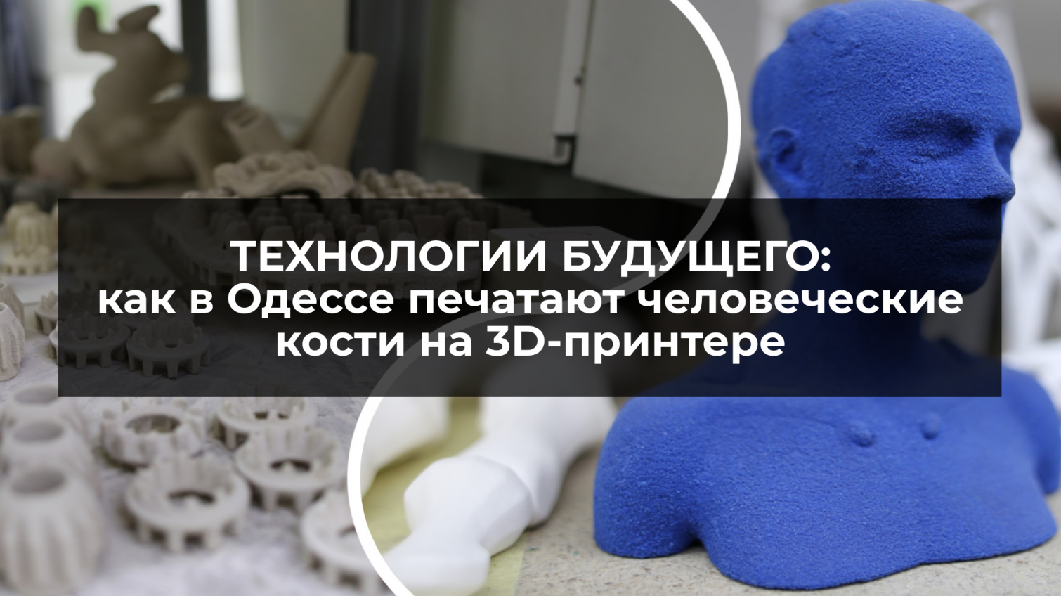 Технологии будущего: как в Одессе печатают человеческие кости на 3D-принтере (фото, видео) «фото»