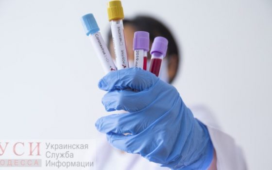 В Одесскую область отправят 3 тысячи тестов на коронавирус, но когда, пока неизвестно usionline.com В Одесскую область отправят 3 тысячи тестов на коронавирус, но когда, пока неизвестно «фото»