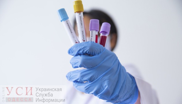В Одесскую область отправят 3 тысячи тестов на коронавирус, но когда, пока неизвестно «фото»