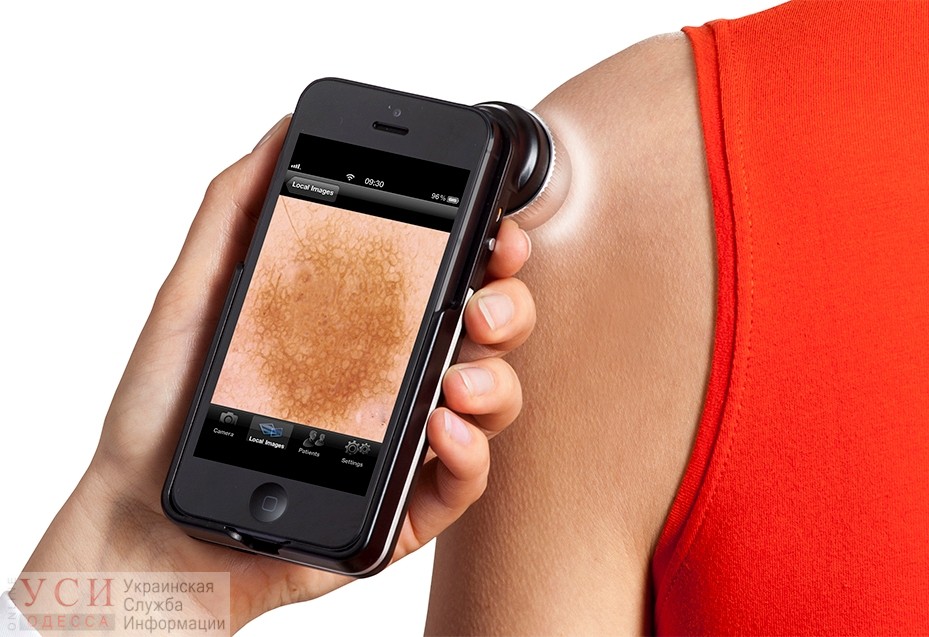 Одесситы могут бесплатно провериться на рак кожи «фото»