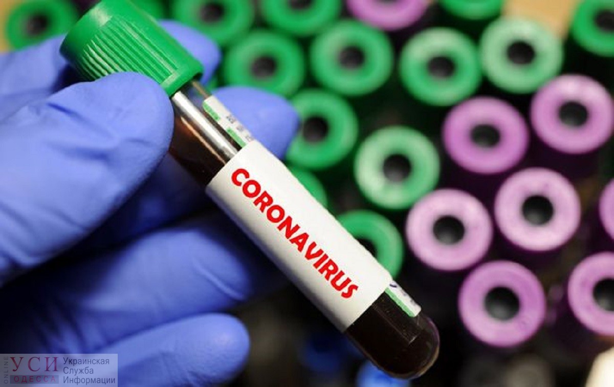 В Одесской области подтвердились еще 3 случая коронавируса «фото»