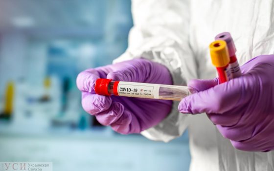 В Одесской области 66 человек с подозрением на коронавирус ждут анализов «фото»