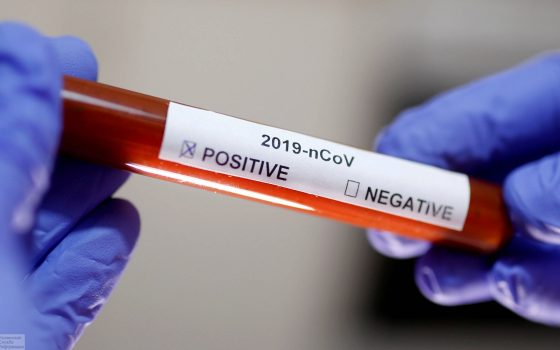 Официальные данные МОЗ: в Одесской области – первый заболевший, а в Украине – четвертая жертва «фото»