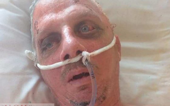 В больнице Одессы ищут родственников или знакомых пострадавшего в ДТП (фото) «фото»