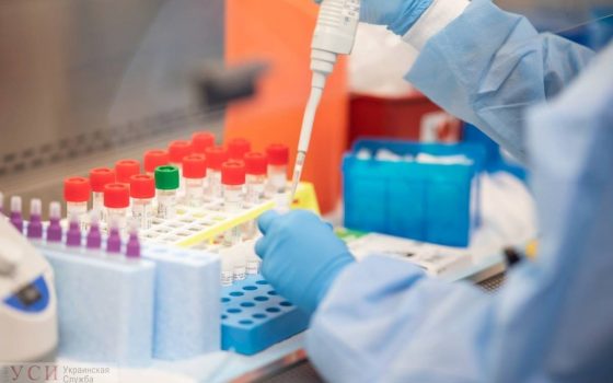 В Одессе двое новых больных коронавирусом: одна из заболевших – в реанимации «фото»