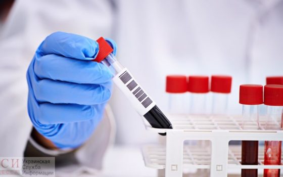 Наконец-то в Одессе: пятого с коронавирусом установили впервые на месте «фото»