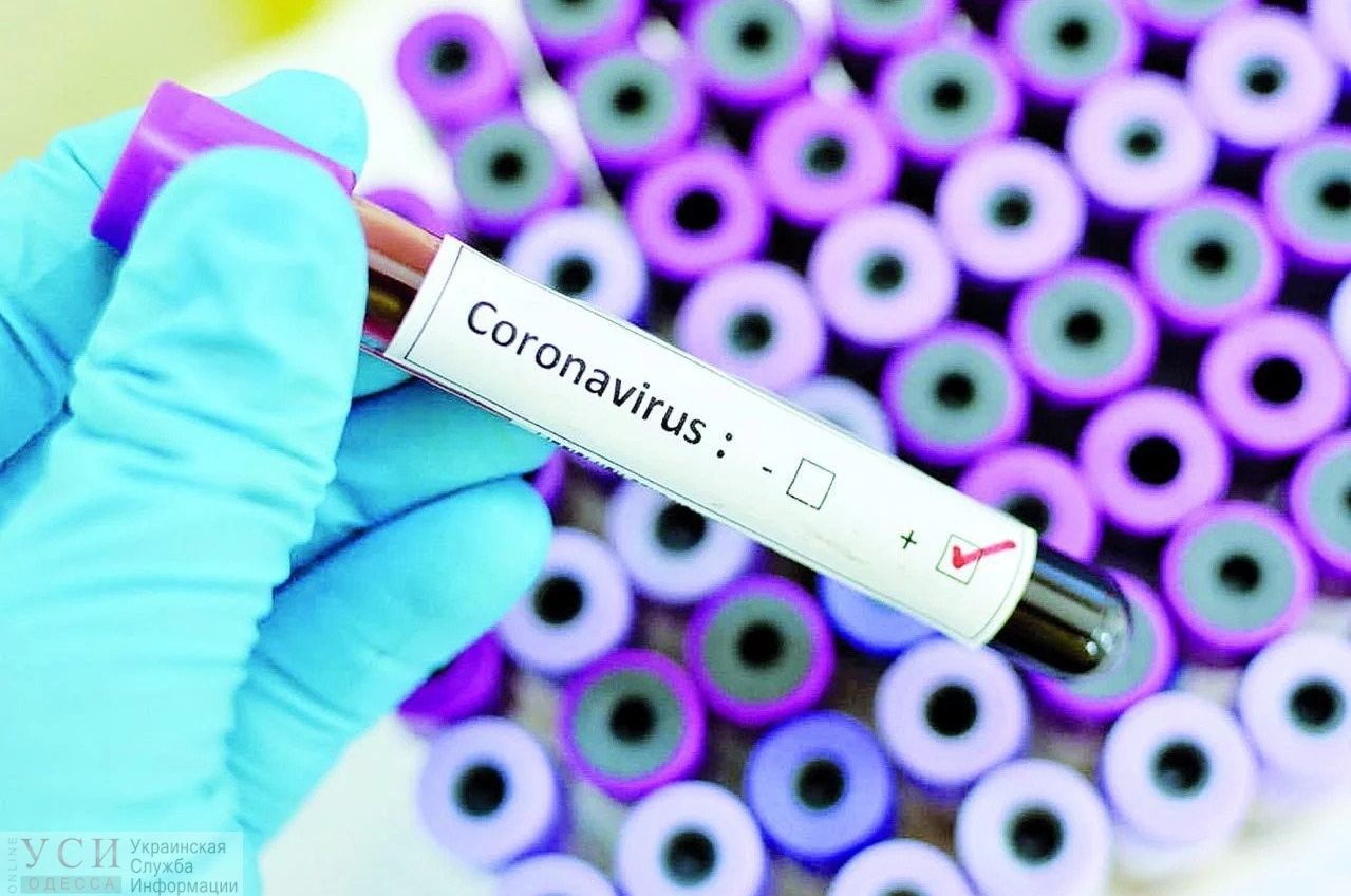 Выявить коронавирус за 20 минут: одесская инфекционка заказывает тесты за 3 миллиона «фото»