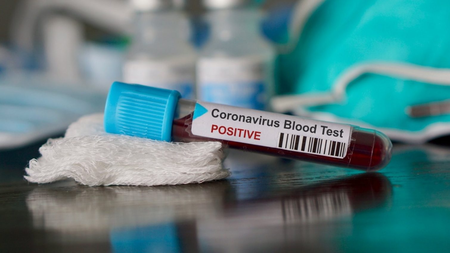 Прокурорский скандал: у правоохранителя обнаружили коронавирус, а еще у одного – не подтвердили ОБНОВЛЕНО «фото»
