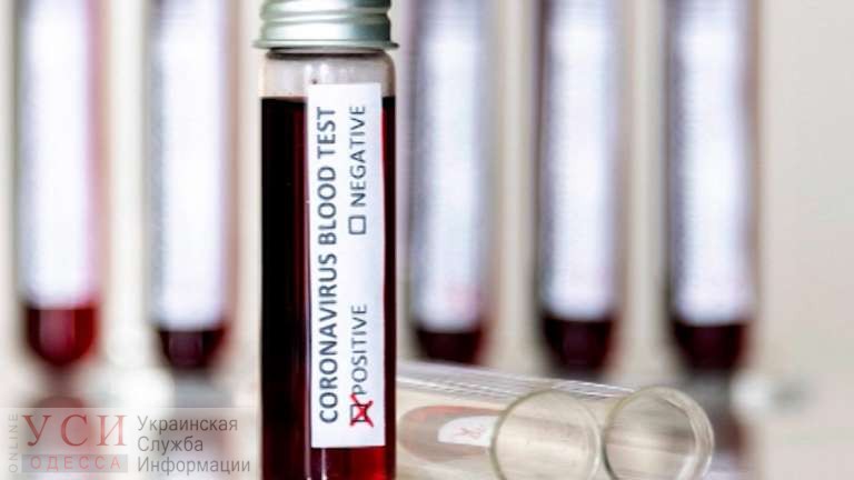 Одесса получит первые 50 тестов для диагностики коронавируса «фото»
