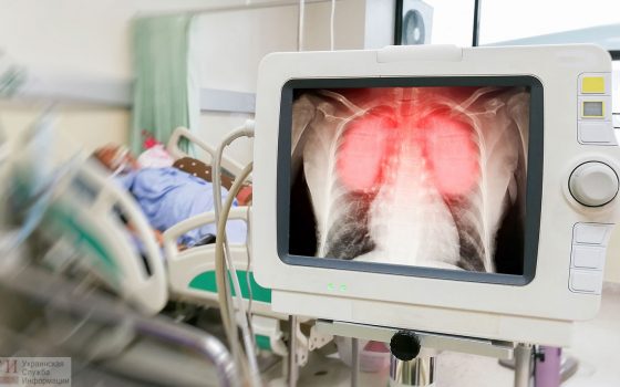 15-й смертный случай: в одесской больнице умерла 90-летняя пациентка с COVID-19, она была участницей Второй мировой «фото»