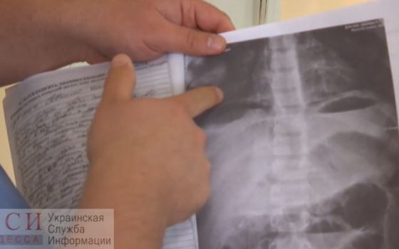 Смерть ребенка на операционном столе в Любашевке: в животе мальчика нашли металл «фото»