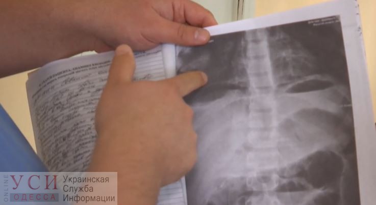 Смерть ребенка на операционном столе в Любашевке: в животе мальчика нашли металл «фото»
