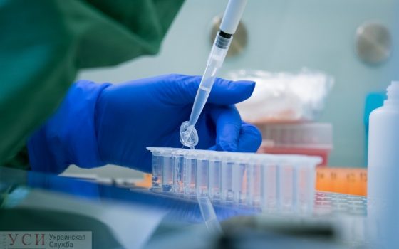 Одесская область вошла в ТОП-5 по количеству тестов на COVID-19, но это всего 1 тест на 200 человек «фото»