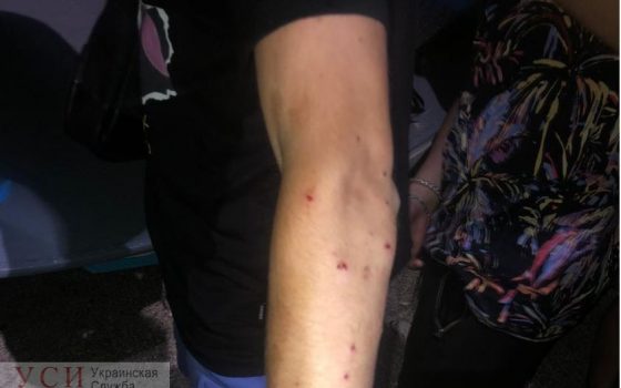 Они слишком шумели: в Одессе мужчина стрелял по отдыхающим из ружья (фото) «фото»