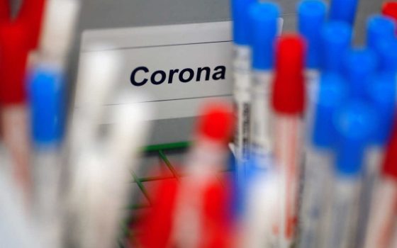 В Одессе закупают свои ИФА-тесты, которые позволяют определить переболевших коронавирусом «фото»