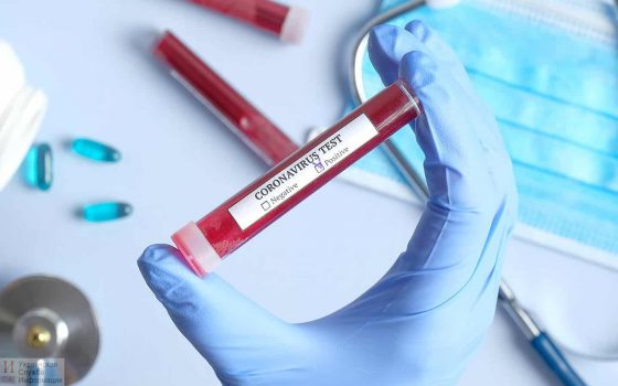 COVID-19 нашли у 7 работников одесского управления миграционной службы «фото»