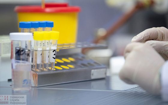 В Одессе начали проводить ИФА-тесты на коронавирус: кто и где будет их проходить «фото»