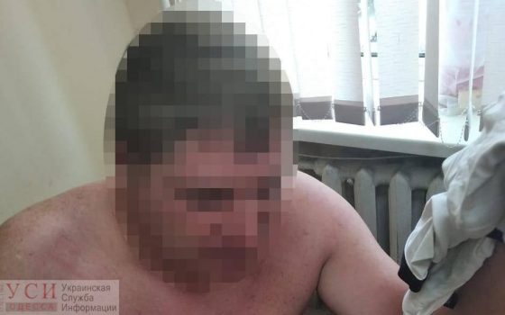 В Одесской области водитель покусал полицейских (фото) «фото»