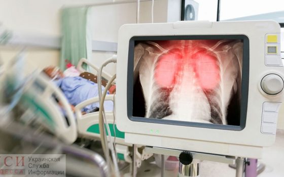 Пожилой одессит и пенсионерка из области умерли в больнице с диагнозом COVID-19 «фото»