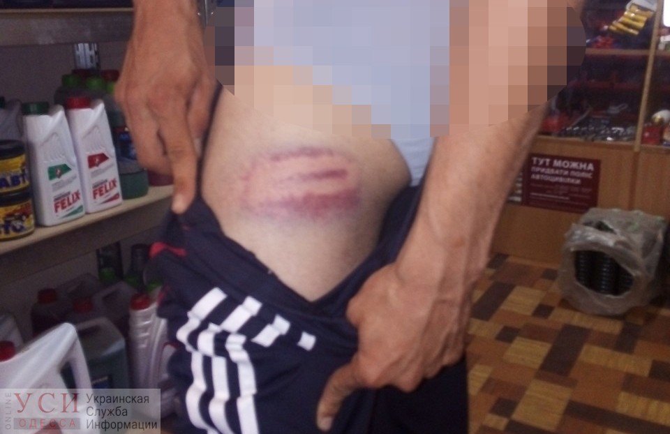 Избил и надел наручники: полицейскому, применившему силу, грозит 8 лет тюрьмы (фото, видео) «фото»