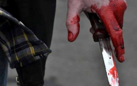 Одессита, который выгуливал собаку без намордника, незнакомец ранил ножом в грудь «фото»