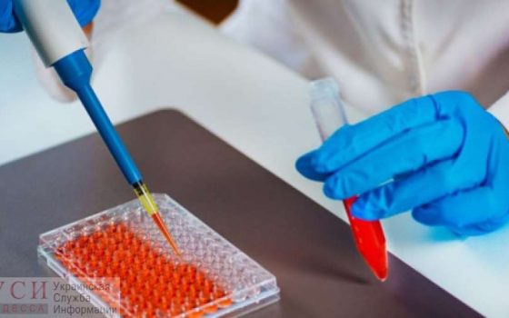 COVID-19: в Одессе студентам из других регионов будут бесплатно проводить ИФА-тесты «фото»