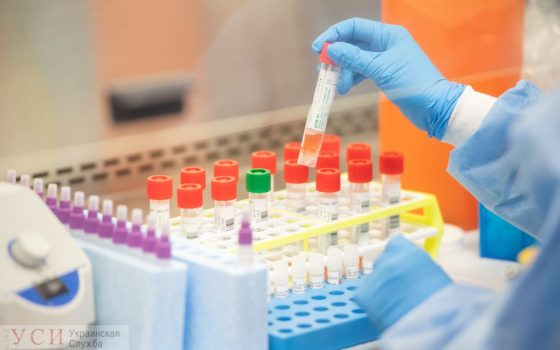 В Одесской области задерживаются результаты тестов на COVID-19: у поставщиков не хватает реагентов «фото»