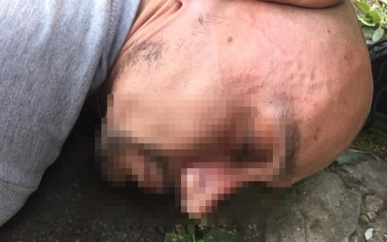 Жестокого убийцу девушки-фармацевта в Одессе задержали: после нападения он вскрыл сейф с 70 тыс. грн ОБНОВЛЕНО «фото»