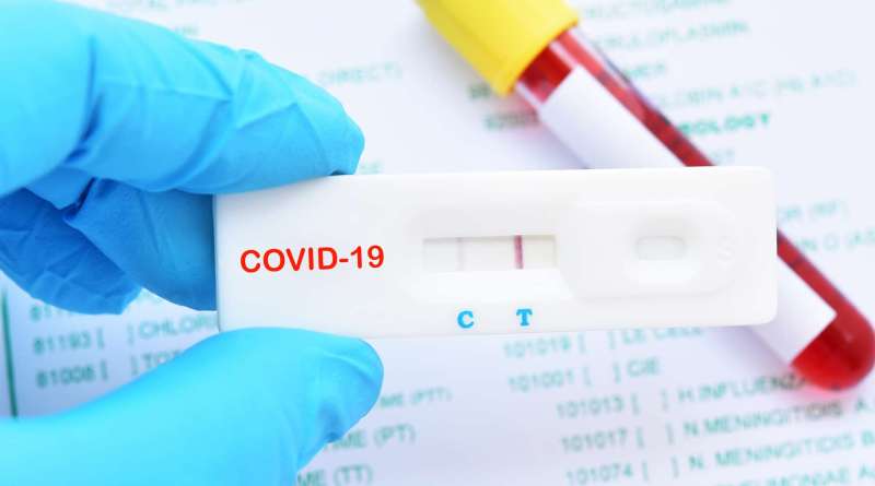 Вирус прячется: у трети больных COVID-19 может быть отрицательный ПЦР-тест «фото»