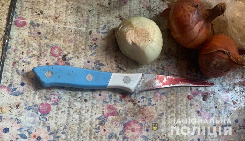 На юге Одесской области мужчина убил друга своего отца 📷 «фото»