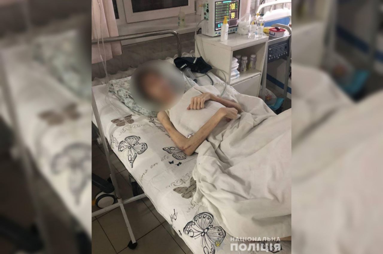 В Одессе будут лечить 16-летнего парня с крайним истощением: против отца открыли дело «фото»